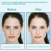Face and Neck Massager – At-Home Spa Treatment for Women Who Care