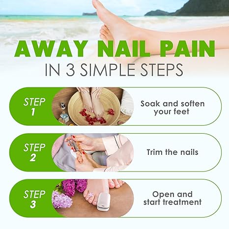 💡 Nail Fungus Light – Safe, Easy & Effective At-Home Solution for Healthier Nails 👣🧼🔵